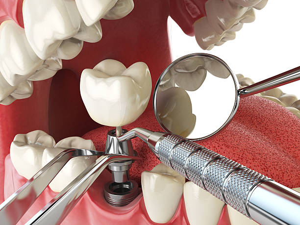 Best Emergency Treatment for Toothache in Jersey Village, TX